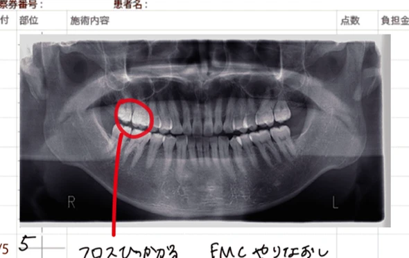 画像挿入も簡単