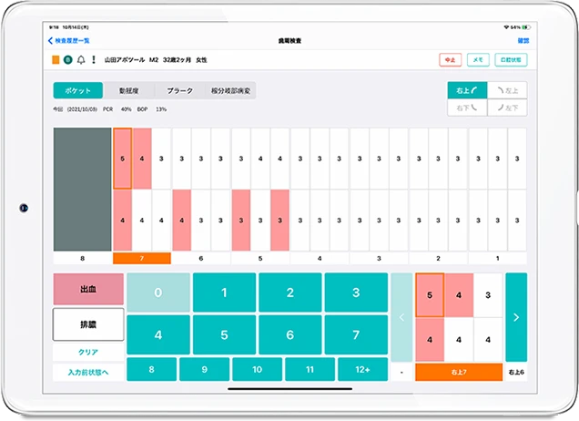 歯周検査記録「Medical Box Perio」